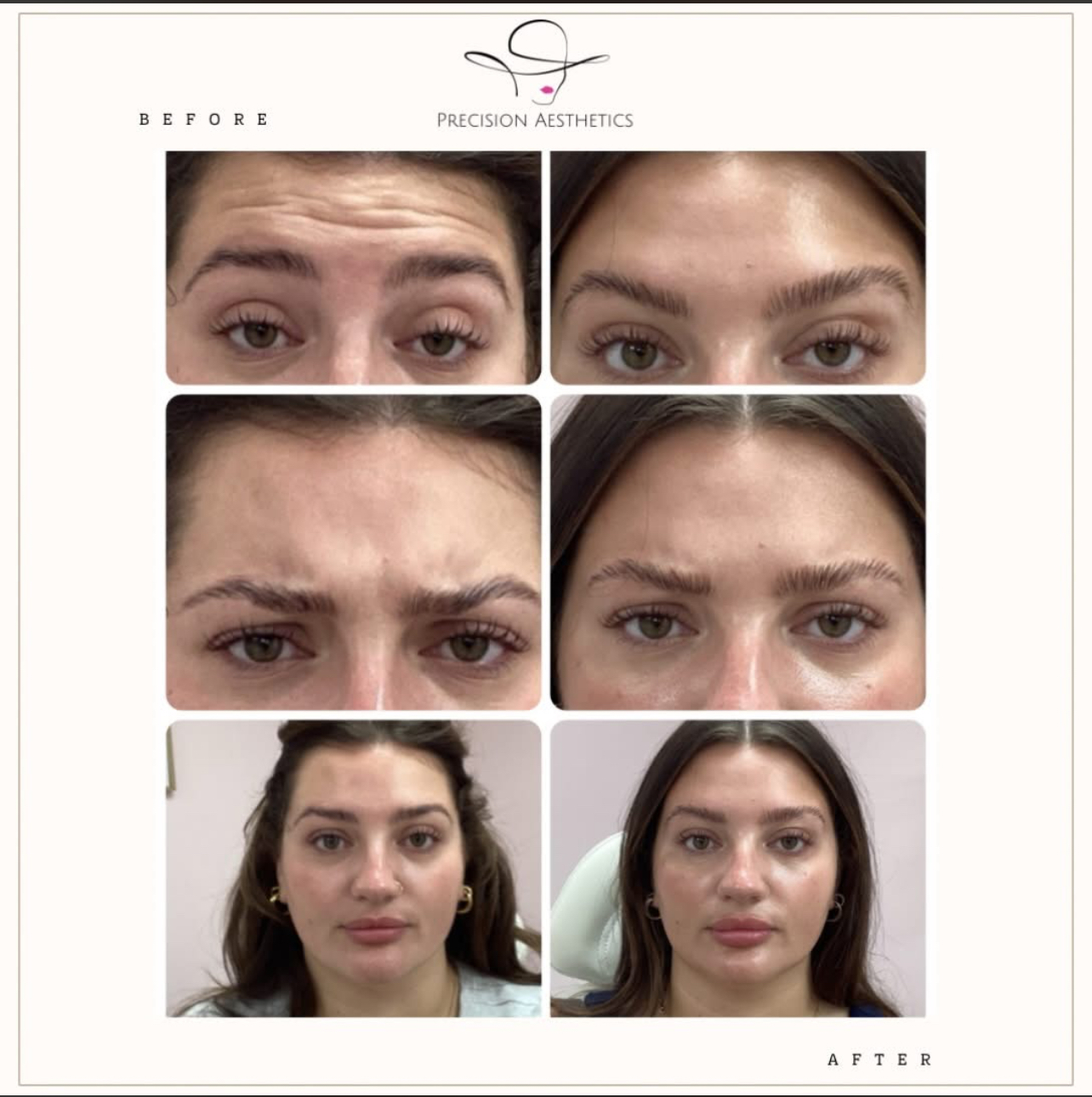 Wrinkle release before and after